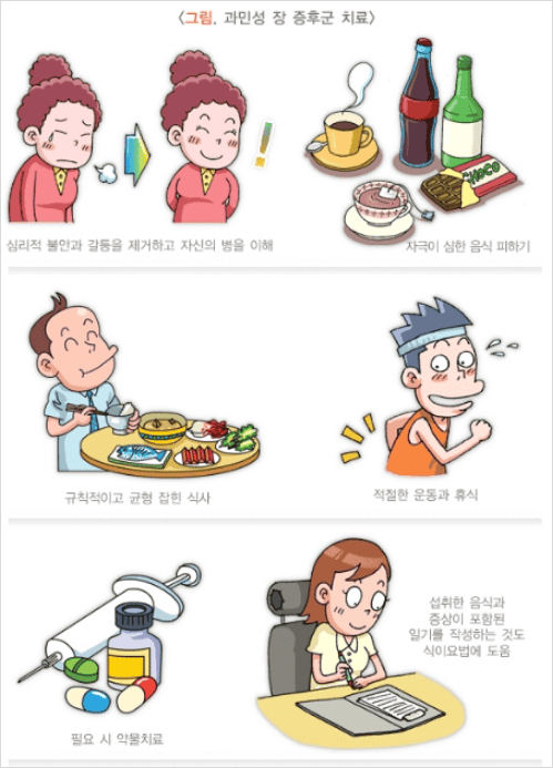 과민성대장증후군 치료