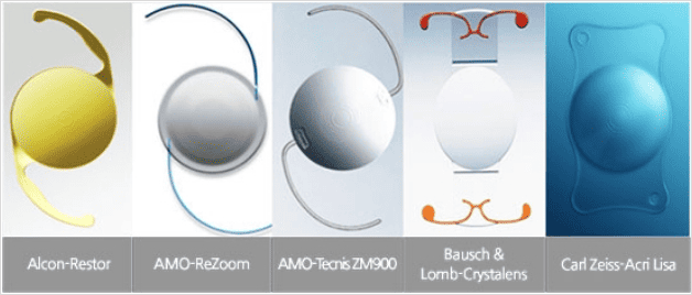 백내장 인공수정체