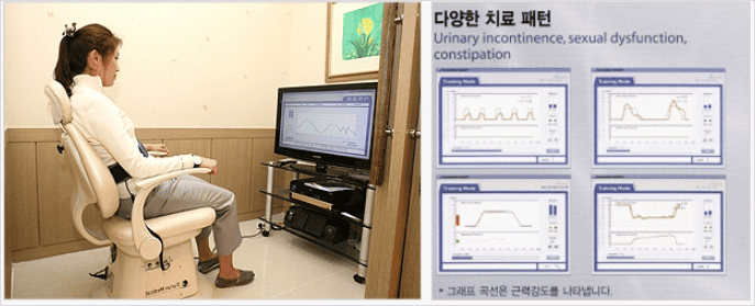 바이오 피드백 치료