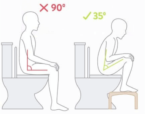 변비에 좋은 자세 취하기