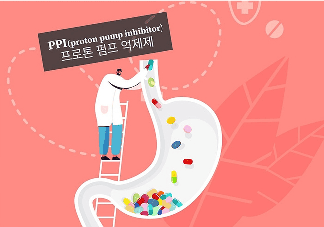 위산 억제제