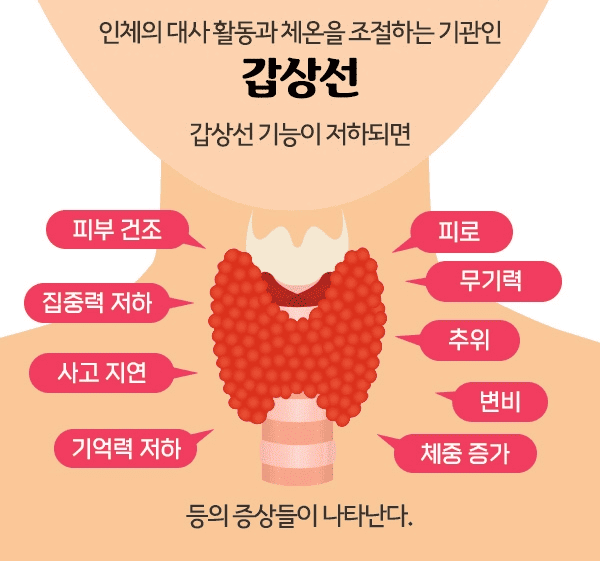 갑상선 기능 저하증