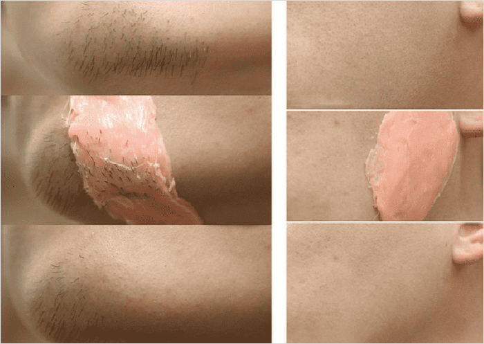 수염 제모 셀프왁싱