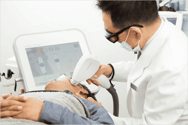 수염 제모 레이저