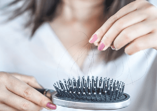 정수리 탈모 관리