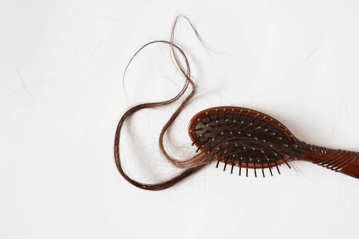 m자 탈모 확인법