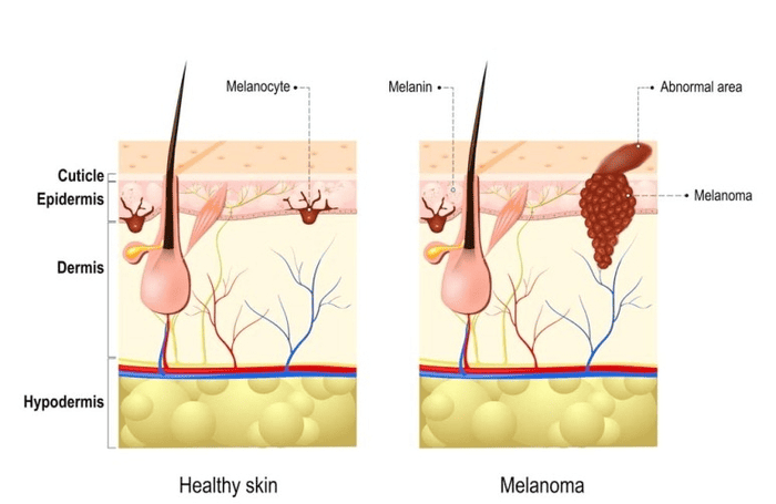 얼굴 점 생기는 이유
