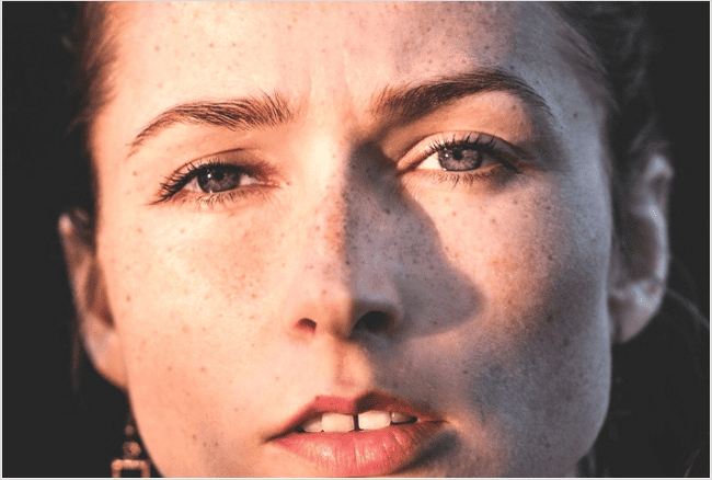 얼굴 점 생기는 이유