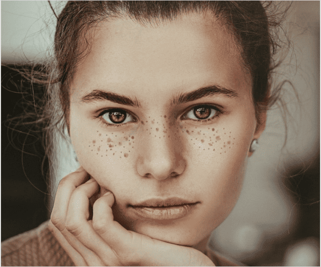 얼굴 점 생기는 이유