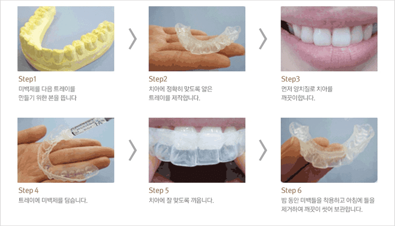 치과 셀프치아미백