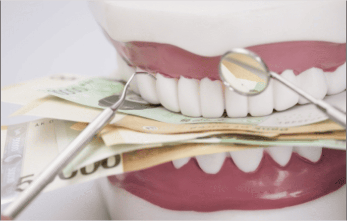 전체 임플란트 가격