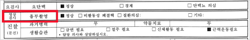 건강검진 흉부촬영