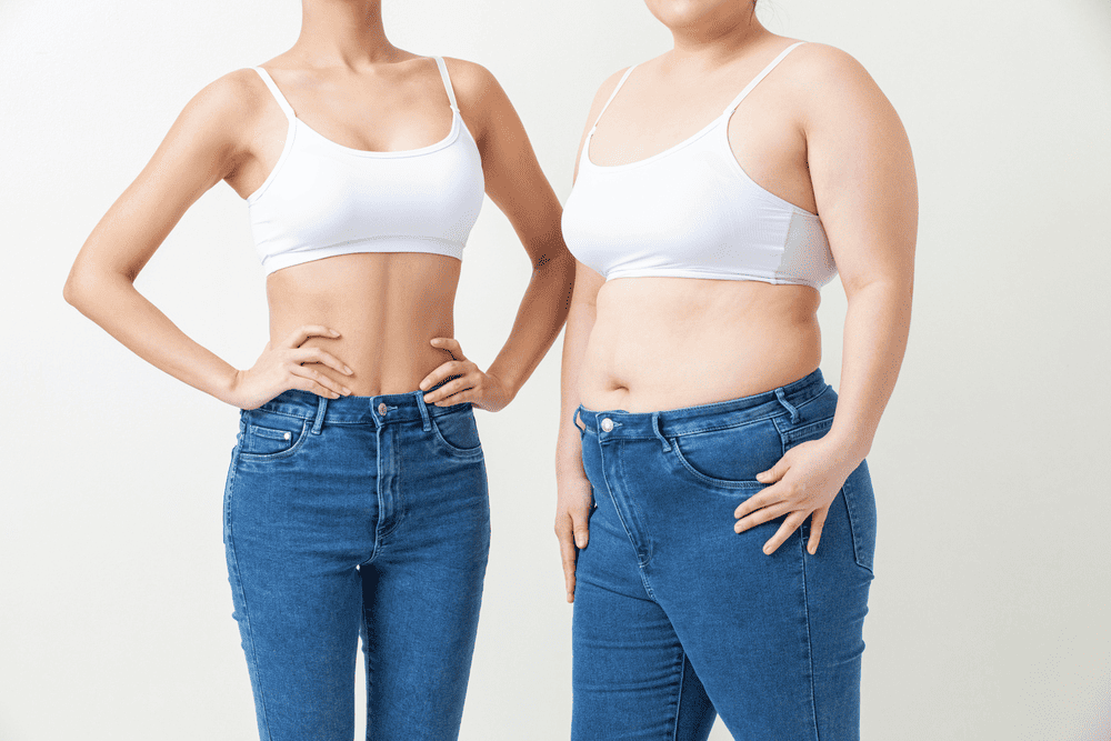 지방흡입술 효과