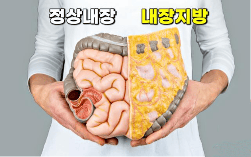 내장지방